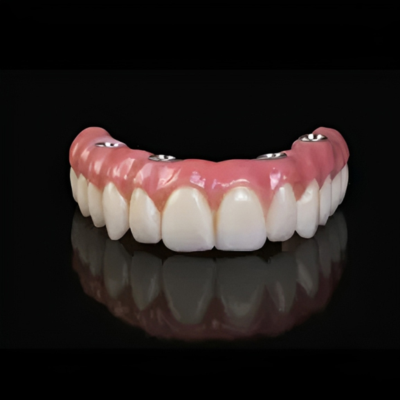 Dental prosthetic showing upper teeth crown with pink gum tissue on black background.