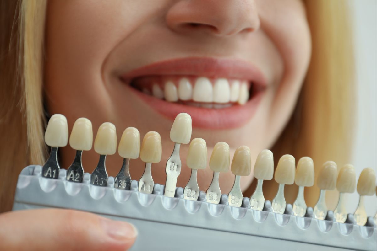 Cosmetic Dentist in McMurray, PA - McMurray Family Dental
